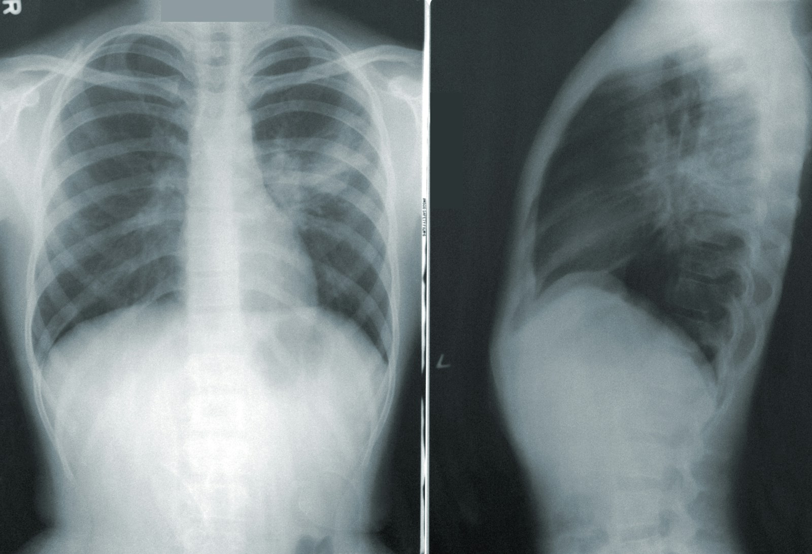 What if a Co-Worker Caused My Injury at Work?